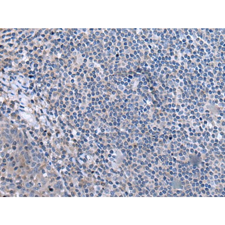 CCK Antibody from Signalway Antibody (43502) - Antibodies.com