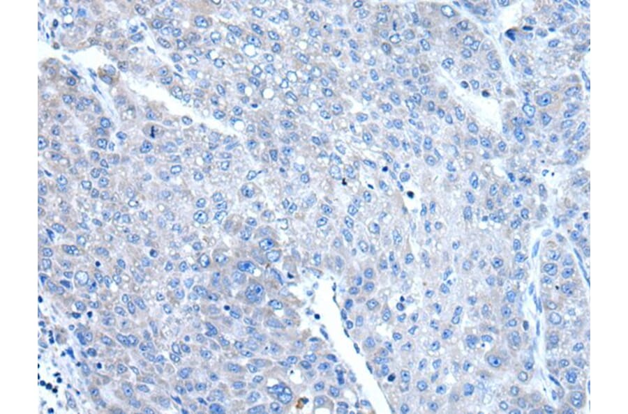 DAP Antibody from Signalway Antibody (43505) - Antibodies.com