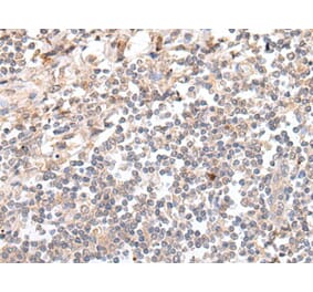 GAL Antibody from Signalway Antibody (43673) - Antibodies.com