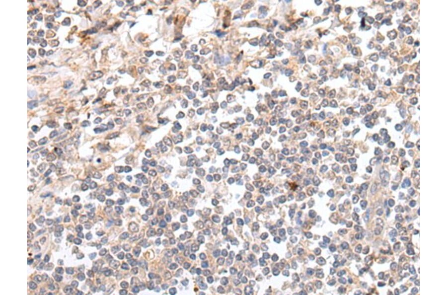 GAL Antibody from Signalway Antibody (43673) - Antibodies.com