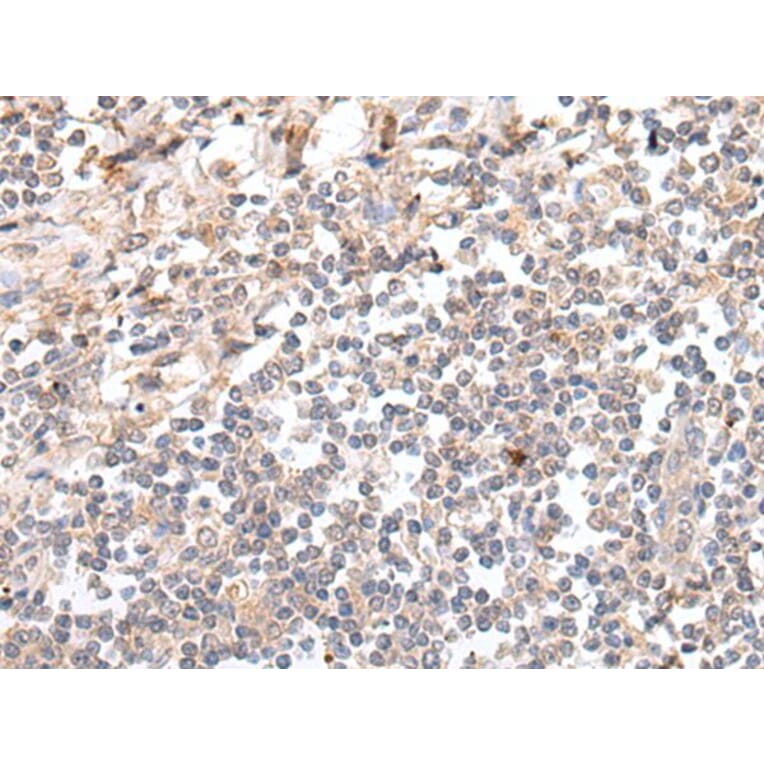 GAL Antibody from Signalway Antibody (43673) - Antibodies.com