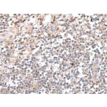 GAL Antibody from Signalway Antibody (43673) - Antibodies.com