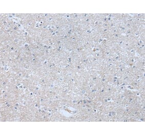 ABR Antibody from Signalway Antibody (43759) - Antibodies.com