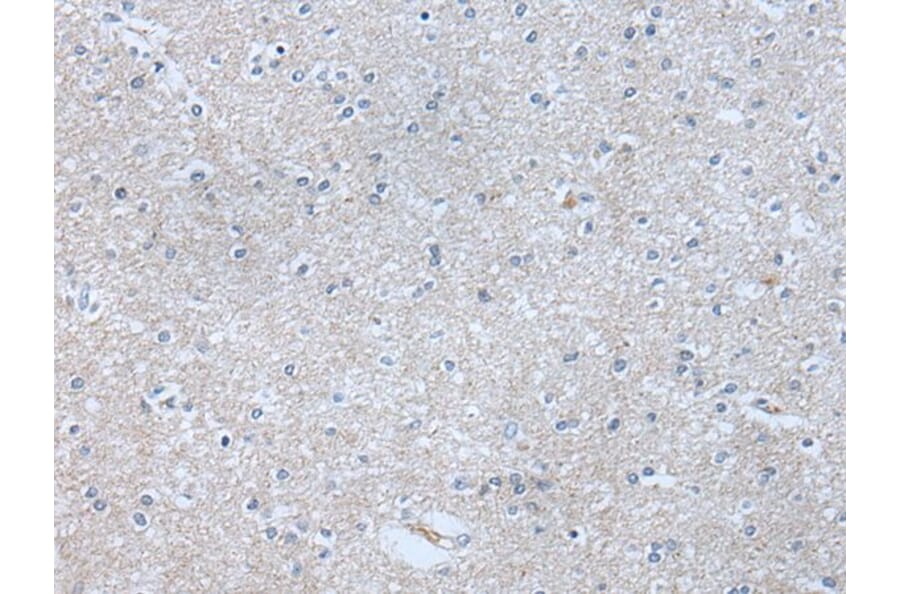 ABR Antibody from Signalway Antibody (43759) - Antibodies.com