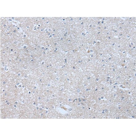 ABR Antibody from Signalway Antibody (43759) - Antibodies.com