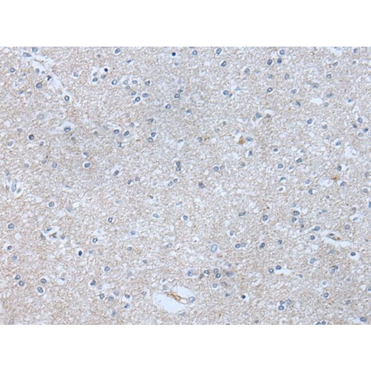 ABR Antibody from Signalway Antibody (43759) - Antibodies.com