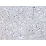 ABR Antibody from Signalway Antibody (43759) - Antibodies.com