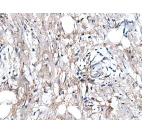 WRN Antibody from Signalway Antibody (43808) - Antibodies.com