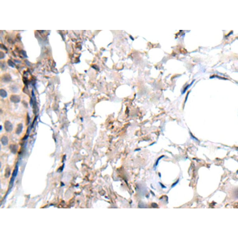 WRN Antibody from Signalway Antibody (43808) - Antibodies.com