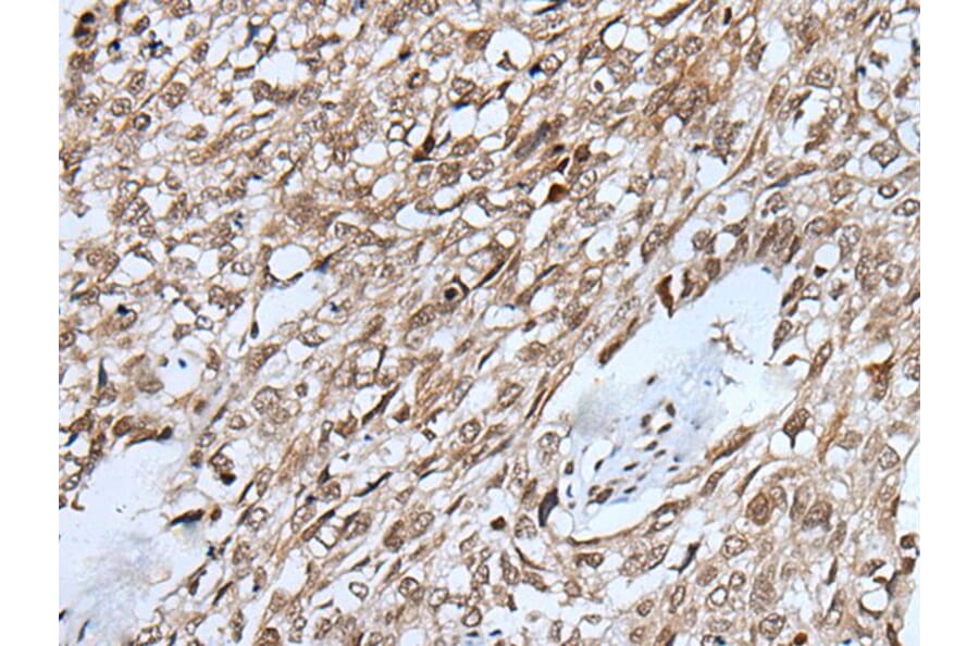 VCX Antibody from Signalway Antibody (43819) - Antibodies.com