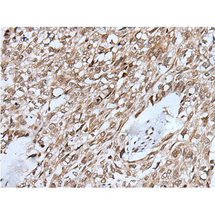 VCX Antibody from Signalway Antibody (43819) - Antibodies.com