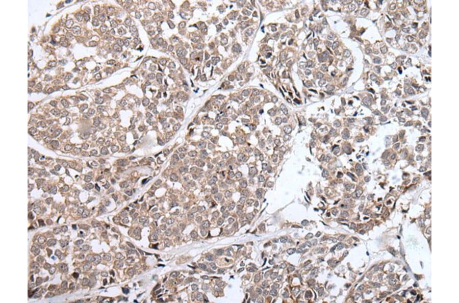 BLM Antibody from Signalway Antibody (43849) - Antibodies.com