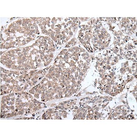 BLM Antibody from Signalway Antibody (43849) - Antibodies.com
