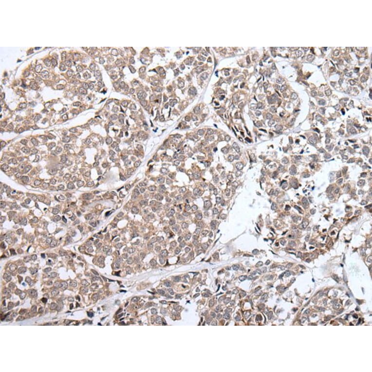 BLM Antibody from Signalway Antibody (43849) - Antibodies.com