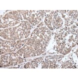 BLM Antibody from Signalway Antibody (43849) - Antibodies.com