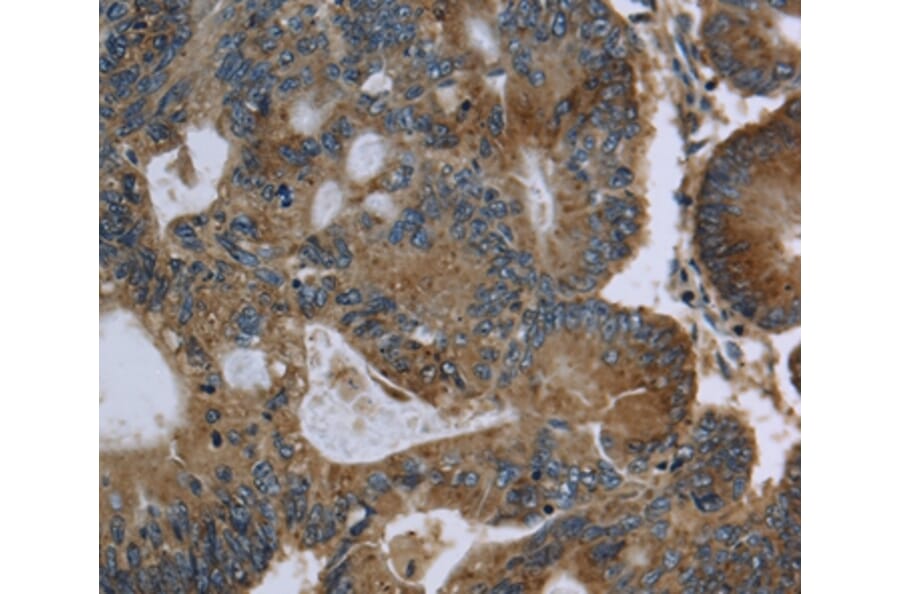 Immunohistochemistry - GK Antibody from Signalway Antibody (36507) - Antibodies.com