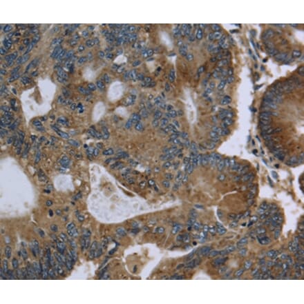 Immunohistochemistry - GK Antibody from Signalway Antibody (36507) - Antibodies.com