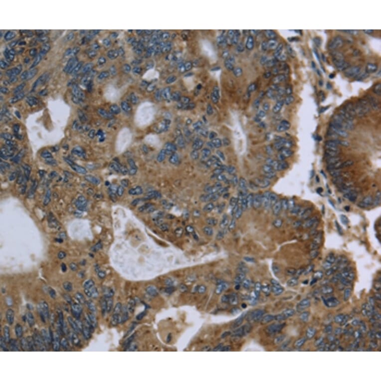 Immunohistochemistry - GK Antibody from Signalway Antibody (36507) - Antibodies.com