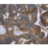 Immunohistochemistry - GK Antibody from Signalway Antibody (36507) - Antibodies.com