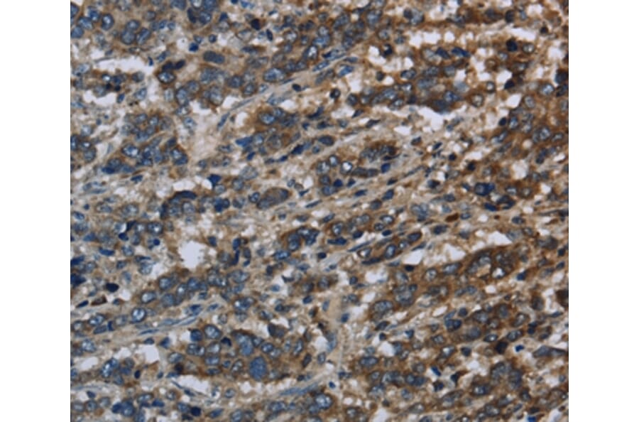 Immunohistochemistry - GK Antibody from Signalway Antibody (36507) - Antibodies.com