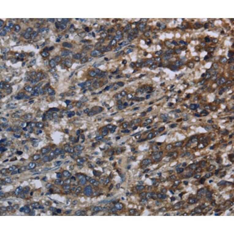 Immunohistochemistry - GK Antibody from Signalway Antibody (36507) - Antibodies.com