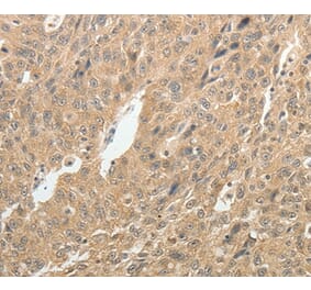 Immunohistochemistry - TH Antibody from Signalway Antibody (37059) - Antibodies.com