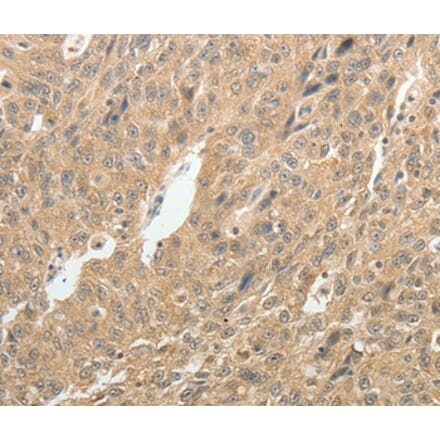 Immunohistochemistry - TH Antibody from Signalway Antibody (37059) - Antibodies.com