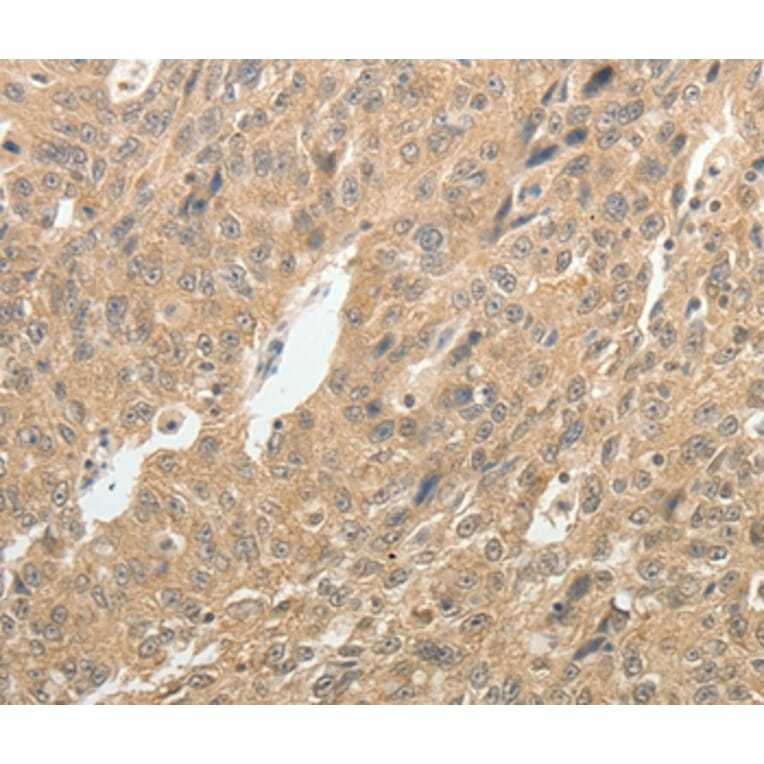 Immunohistochemistry - TH Antibody from Signalway Antibody (37059) - Antibodies.com