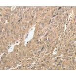 Immunohistochemistry - TH Antibody from Signalway Antibody (37059) - Antibodies.com