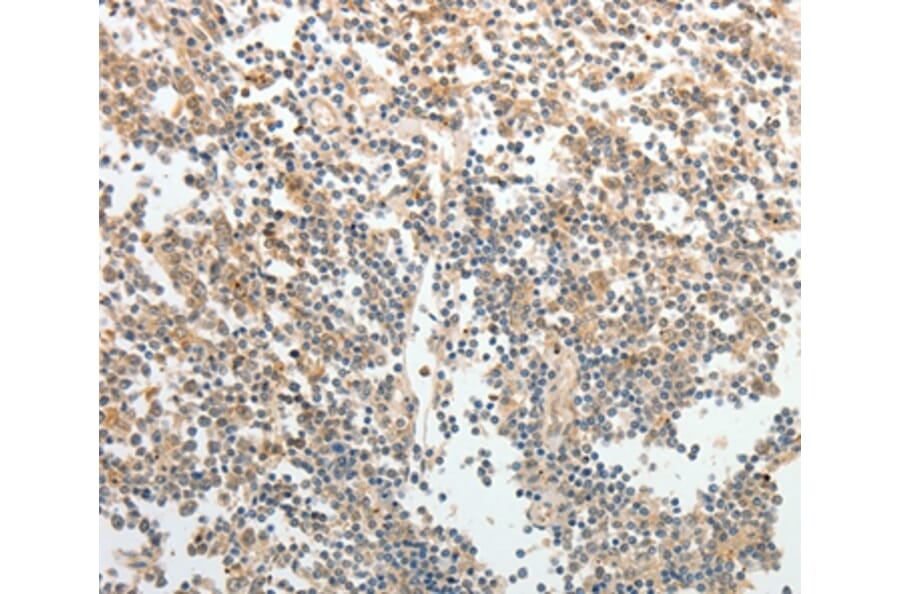 Immunohistochemistry - TH Antibody from Signalway Antibody (37059) - Antibodies.com