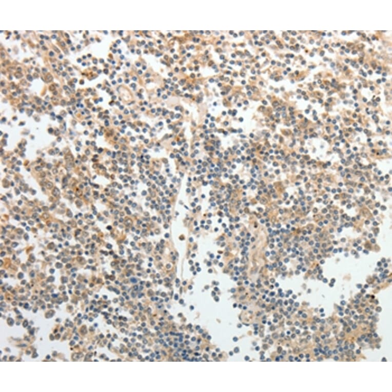 Immunohistochemistry - TH Antibody from Signalway Antibody (37059) - Antibodies.com