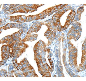 Immunohistochemistry - F2 Antibody from Signalway Antibody (40244) - Antibodies.com