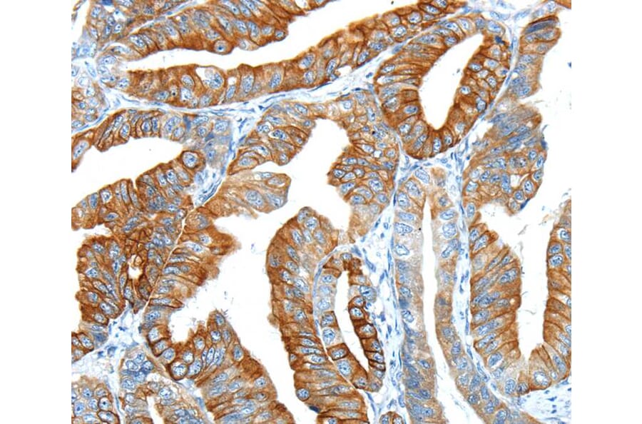 Immunohistochemistry - F2 Antibody from Signalway Antibody (40244) - Antibodies.com