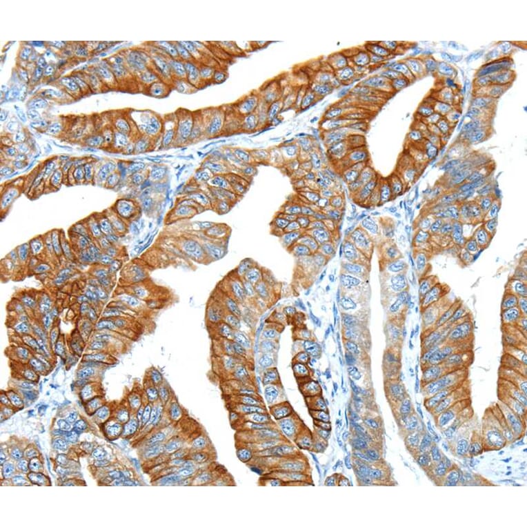 Immunohistochemistry - F2 Antibody from Signalway Antibody (40244) - Antibodies.com