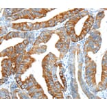 Immunohistochemistry - F2 Antibody from Signalway Antibody (40244) - Antibodies.com
