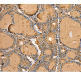 Immunohistochemistry - TG Antibody from Signalway Antibody (40380) - Antibodies.com