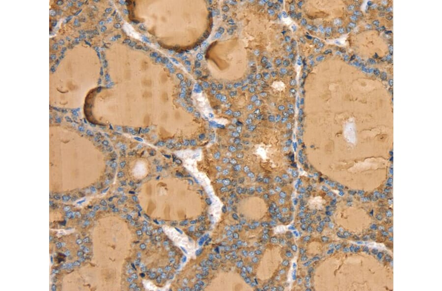 Immunohistochemistry - TG Antibody from Signalway Antibody (40380) - Antibodies.com