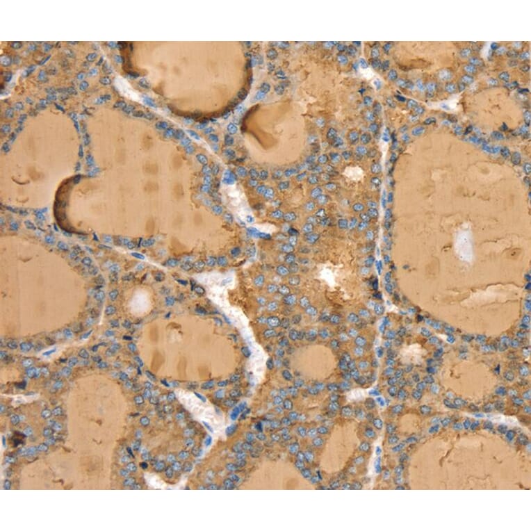 Immunohistochemistry - TG Antibody from Signalway Antibody (40380) - Antibodies.com