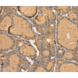 Immunohistochemistry - TG Antibody from Signalway Antibody (40380) - Antibodies.com