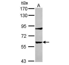 Tyrosine Hydroxylase Antibody from Signalway Antibody (35392) - Antibodies.com