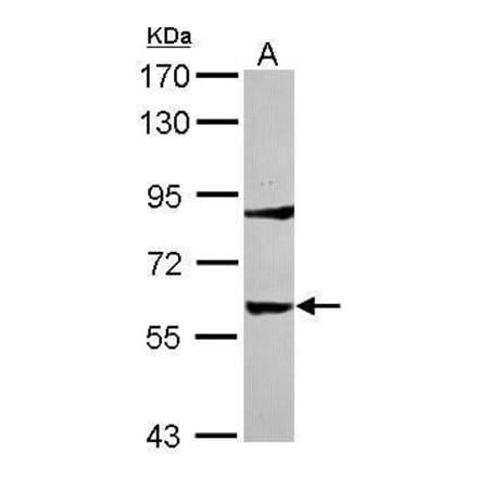 Tyrosine Hydroxylase Antibody from Signalway Antibody (35392) - Antibodies.com