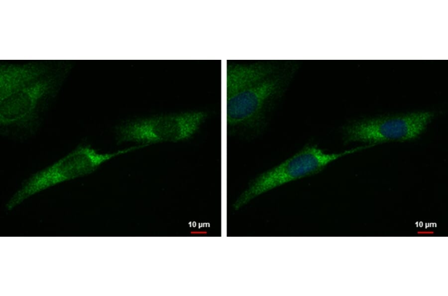 Tyrosine Hydroxylase Antibody from Signalway Antibody (35392) - Antibodies.com