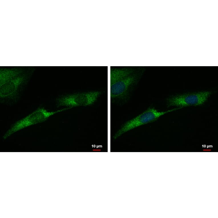 Tyrosine Hydroxylase Antibody from Signalway Antibody (35392) - Antibodies.com