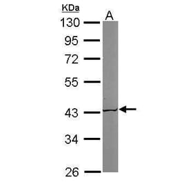 ACAT1 Antibody from Signalway Antibody (35395) - Antibodies.com