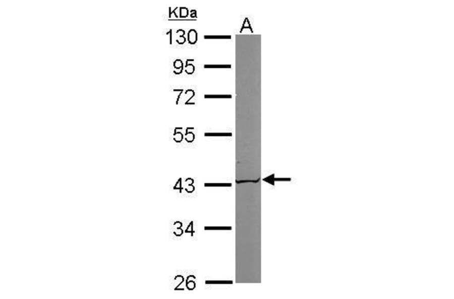 ACAT1 Antibody from Signalway Antibody (35395) - Antibodies.com