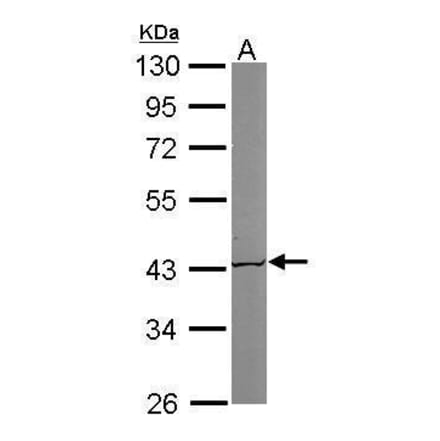 ACAT1 Antibody from Signalway Antibody (35395) - Antibodies.com