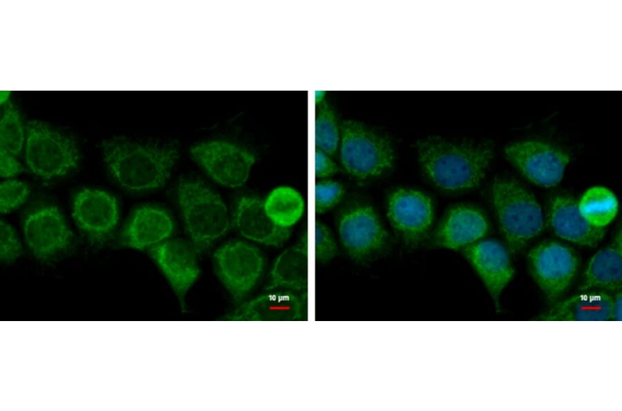 ACAT1 Antibody from Signalway Antibody (35395) - Antibodies.com