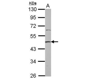 PRMT2 Antibody from Signalway Antibody (35409) - Antibodies.com
