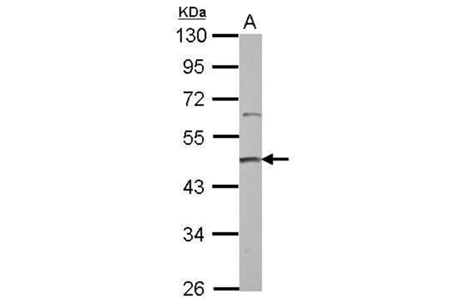 PRMT2 Antibody from Signalway Antibody (35409) - Antibodies.com