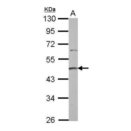 PRMT2 Antibody from Signalway Antibody (35409) - Antibodies.com